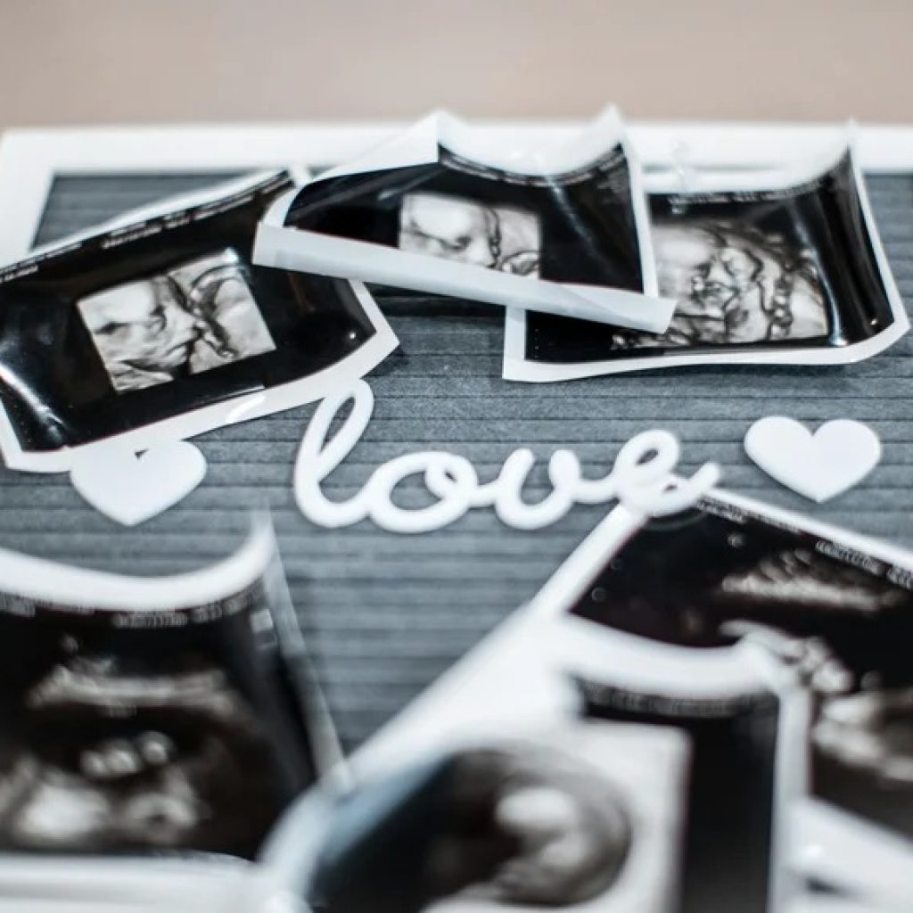 Elective 4D Baby Scan Perth: Clear, Comforting Preview Elective 4D Baby Scan Perth: Clear, Comforting Preview