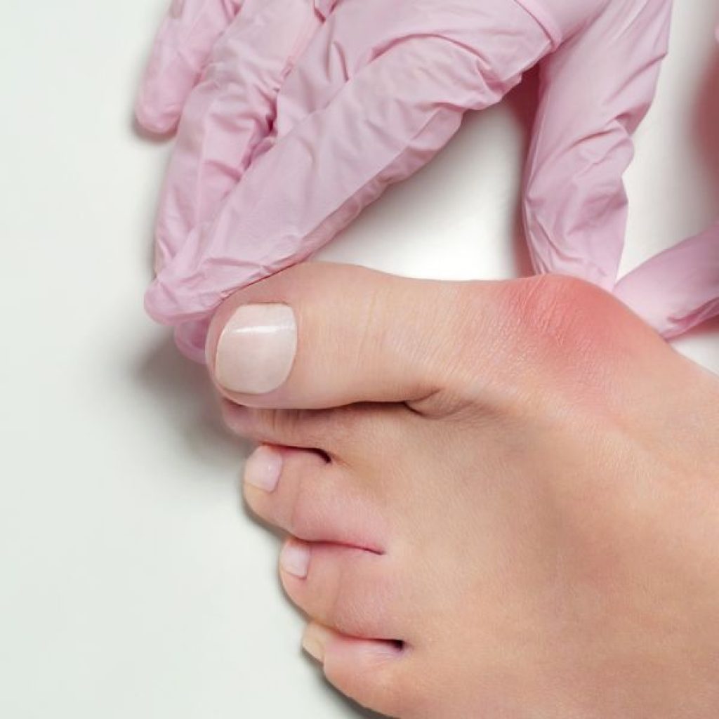 Pediatric Podiatrist | Lmdpodiatry.com