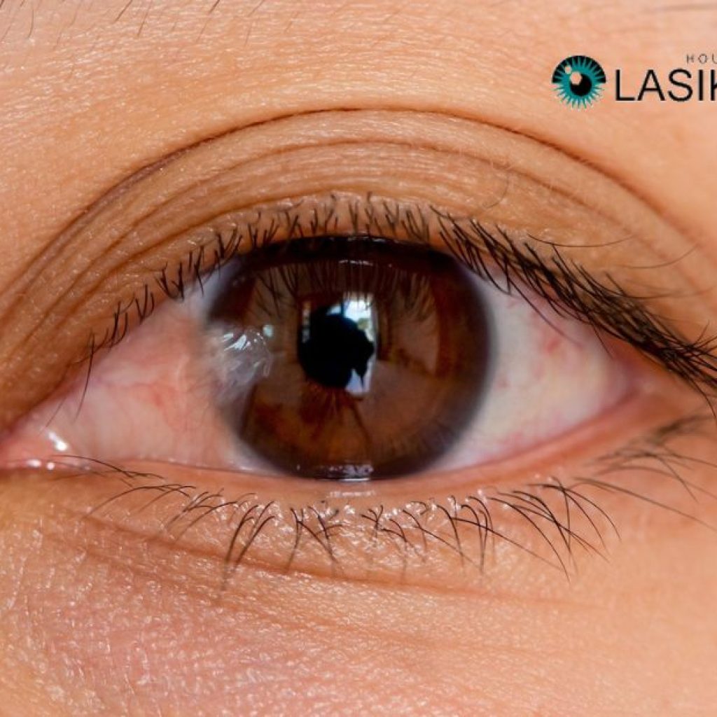 Effective Pterygium Removal: Restore Vision Safely Effective Pterygium Removal: Restore Vision Safely