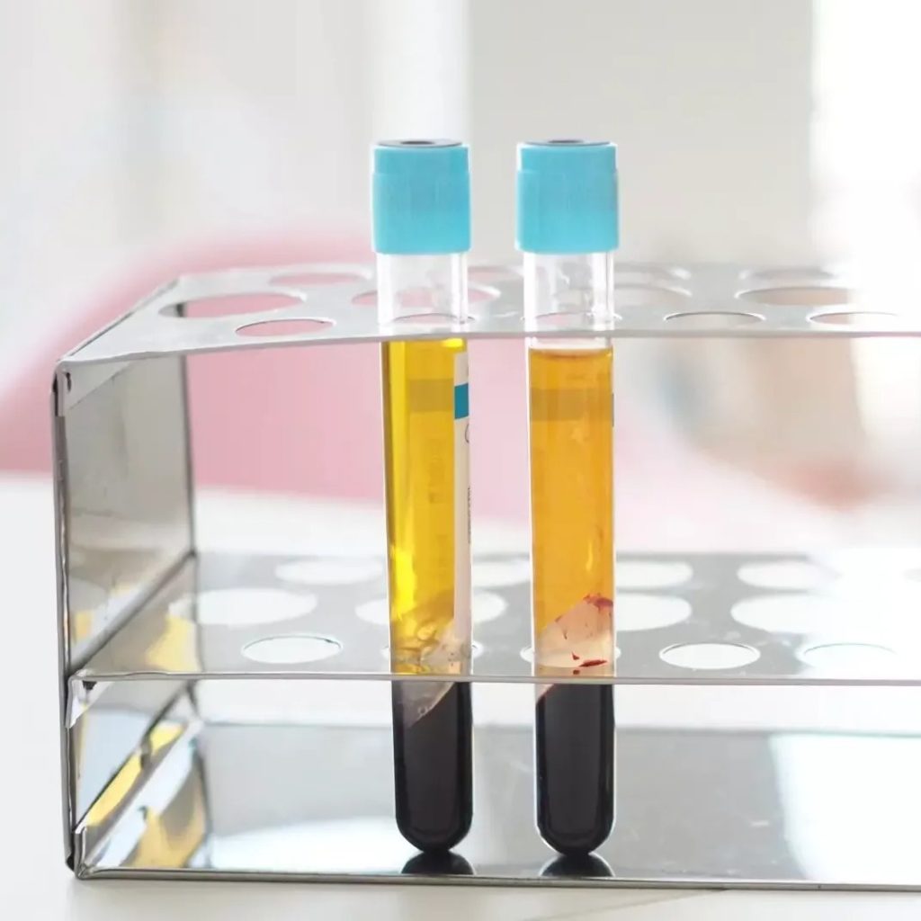 Personalised Skin Treatment | Thecheclinic.co.uk