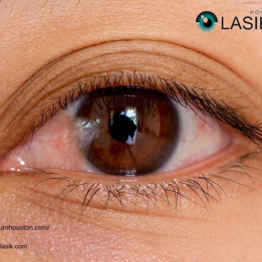 How To Cure Pterygium | Pterygiumhouston.com