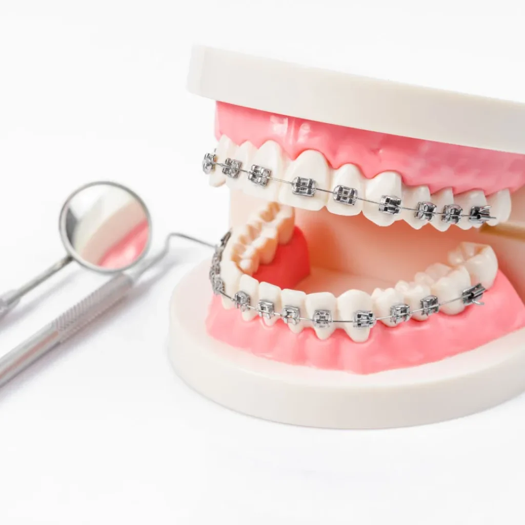 What to expect from Invisalign pricing and value