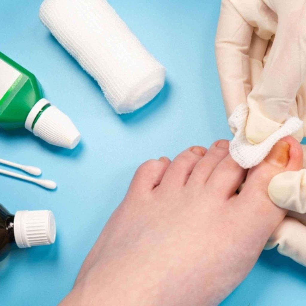 Compassionate Senior Foot Care at Home and Clinic