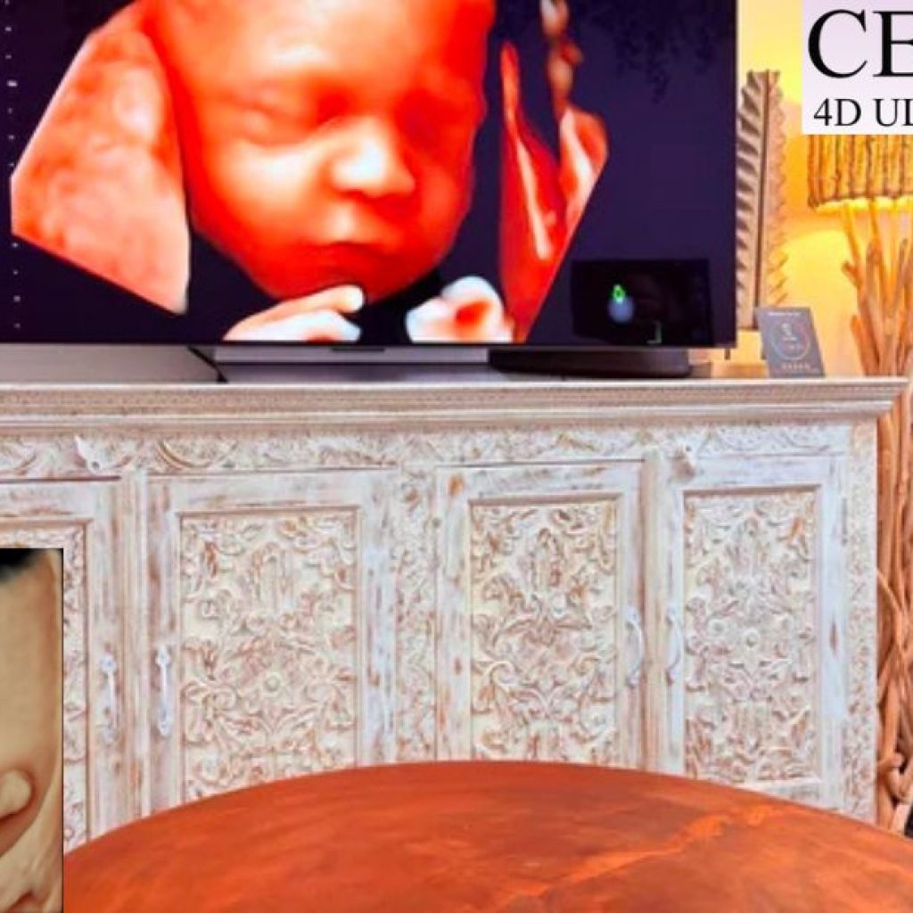 Sophisticated Pregnancy Scans For Lasting Moments Sophisticated Pregnancy Scans For Lasting Moments