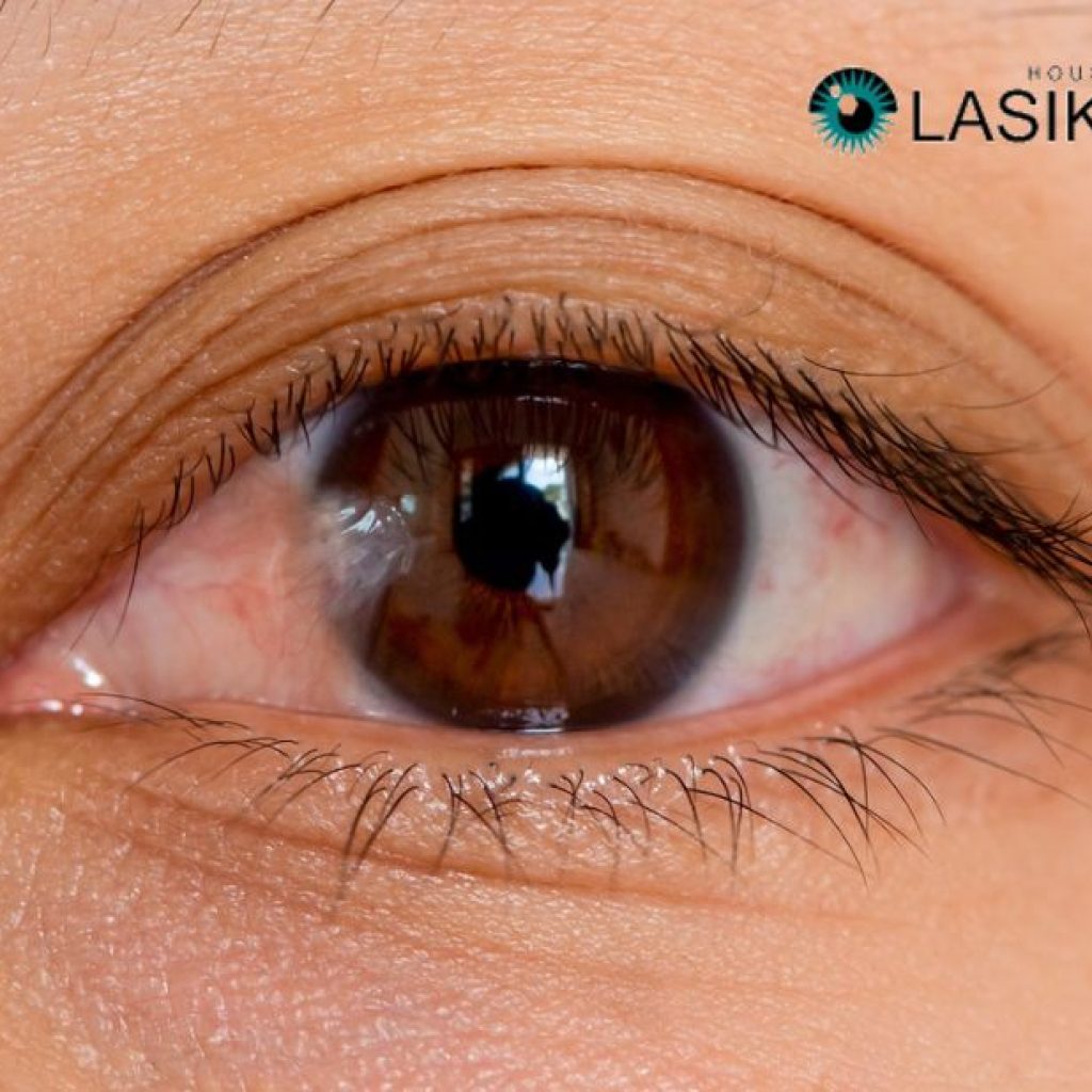 Effective drops for pterygium relief and comfort