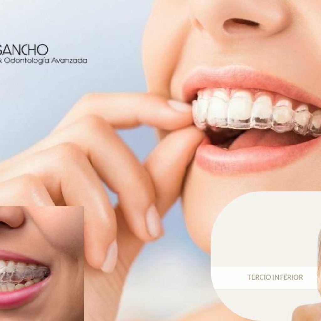 Sonrisa saludable en Pozuelo: tu centro dental de confianza Sonrisa saludable en Pozuelo: tu centro dental de confianza