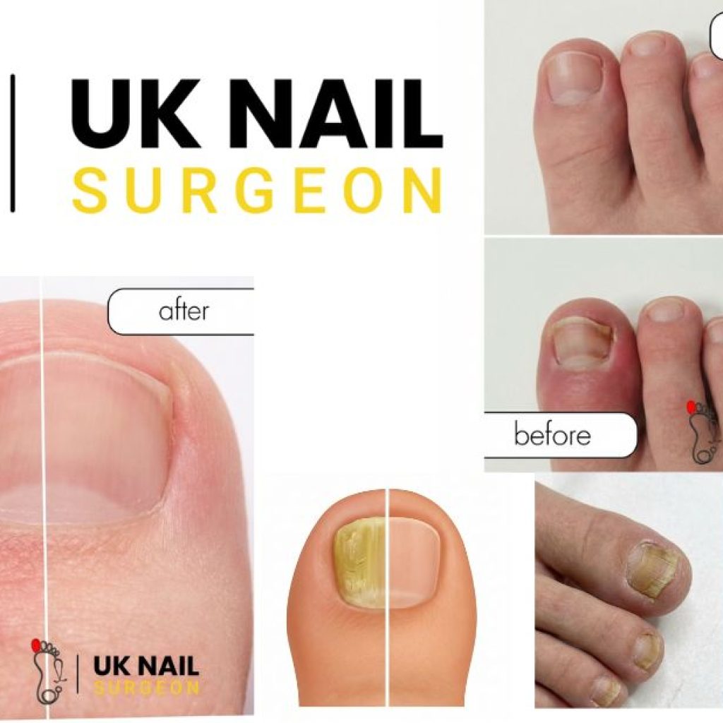 Relieve toe pain quickly with expert care and same-day surgery