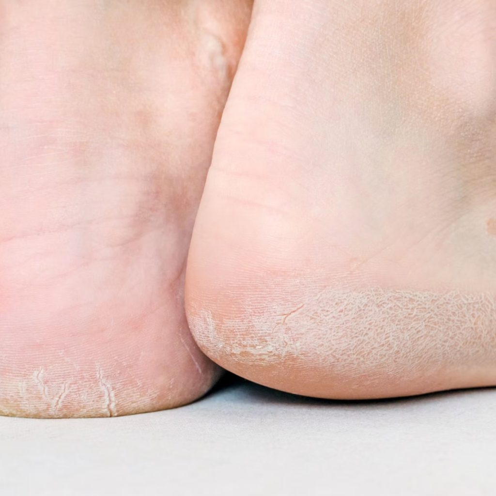 Supportive Foot and Ankle Devices for Everyday Comfort