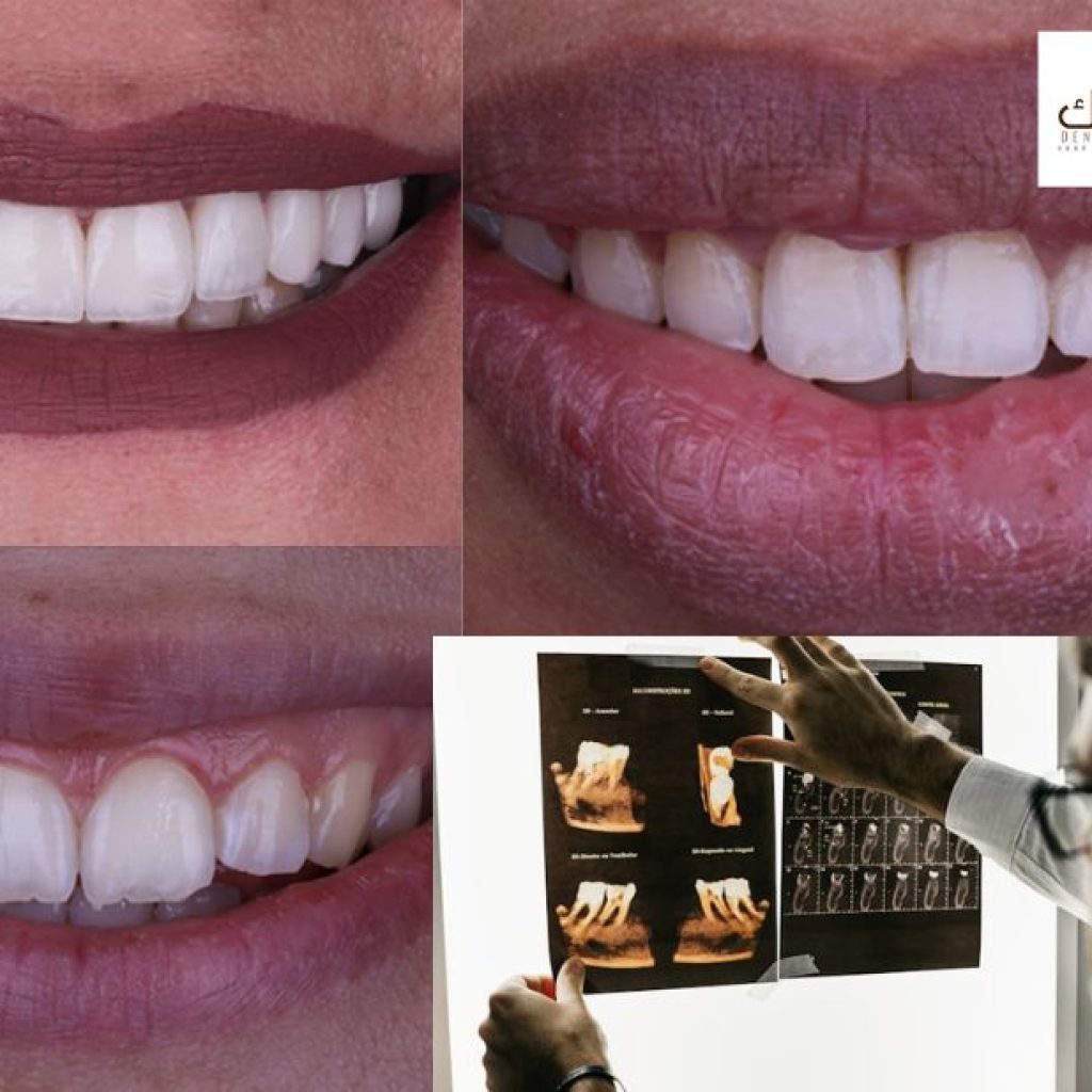 ابتسامة ساحرة: دليل العناية وتجارب العلاج التجميلية للأسنان في العيادات المتخصصة ابتسامة ساحرة: دليل العناية وتجارب العلاج التجميلية للأسنان في العيادات المتخصصة