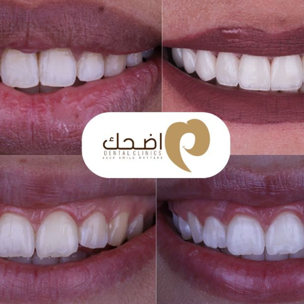 مركز أضحك لطب الأسنان في بنها: رعاية فموية مميزة وقريبة من قلبك
